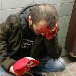 Brutal agresión en el metro de Barcelona a un hombre por llevar una gorra con la bandera de España