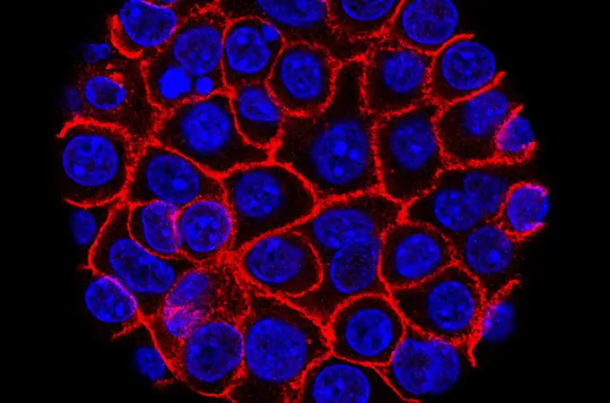 Las células cancerosas pueden crecer por la ruptura cromosómica
