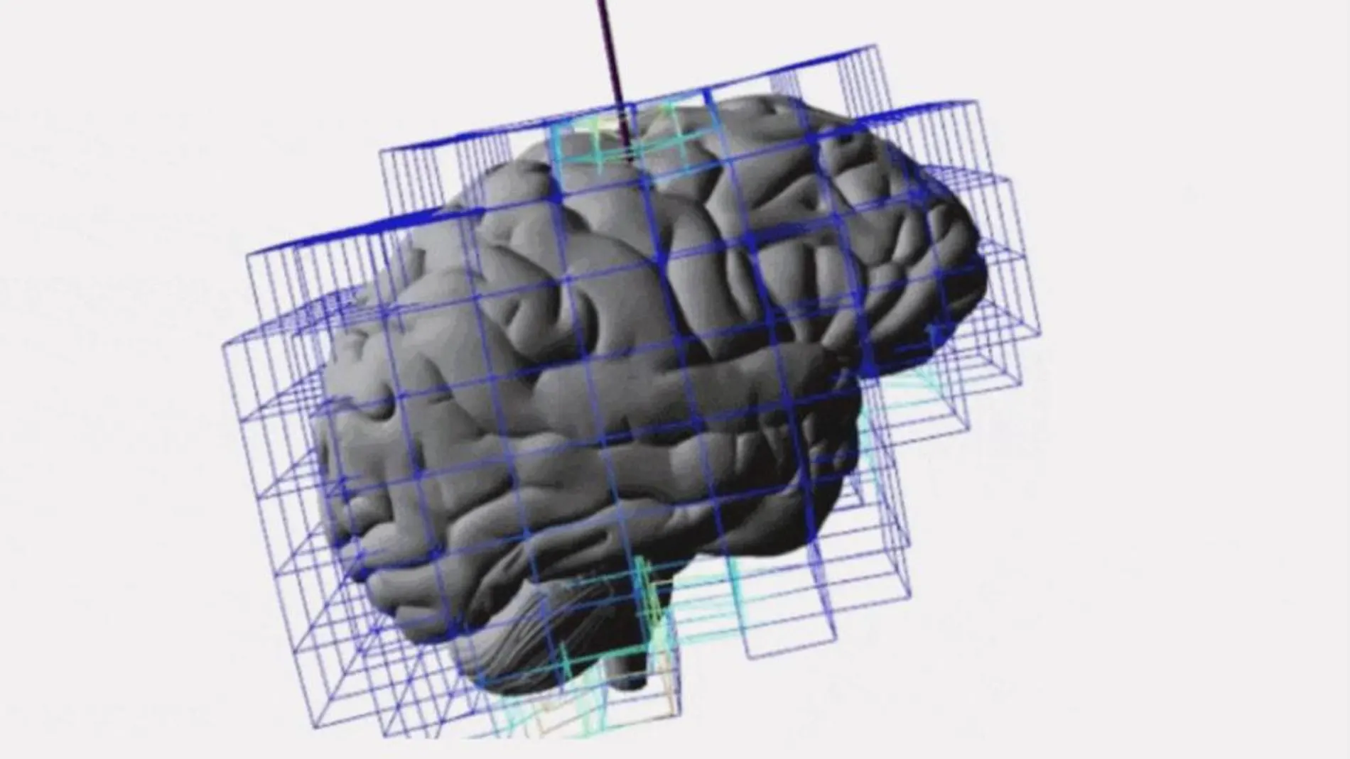 Imagen del sistema desarrollado para ayudar a los neurocirujanos