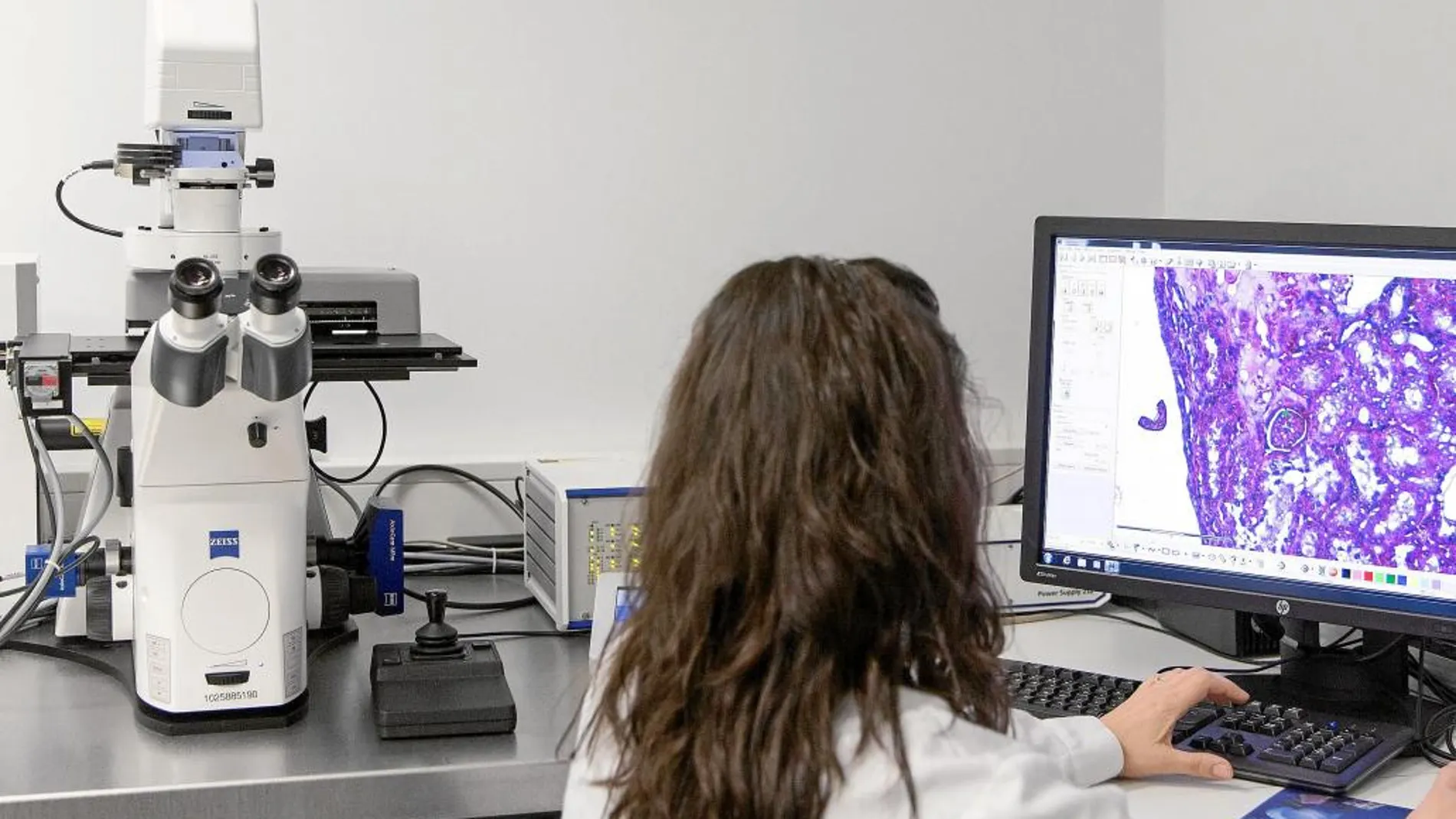 La Usal presenta su nuevo microscopio láser para tratar el cáncer