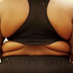 La obesidad convive con más del 23 % de los adultos españoles / Foto: Archivo