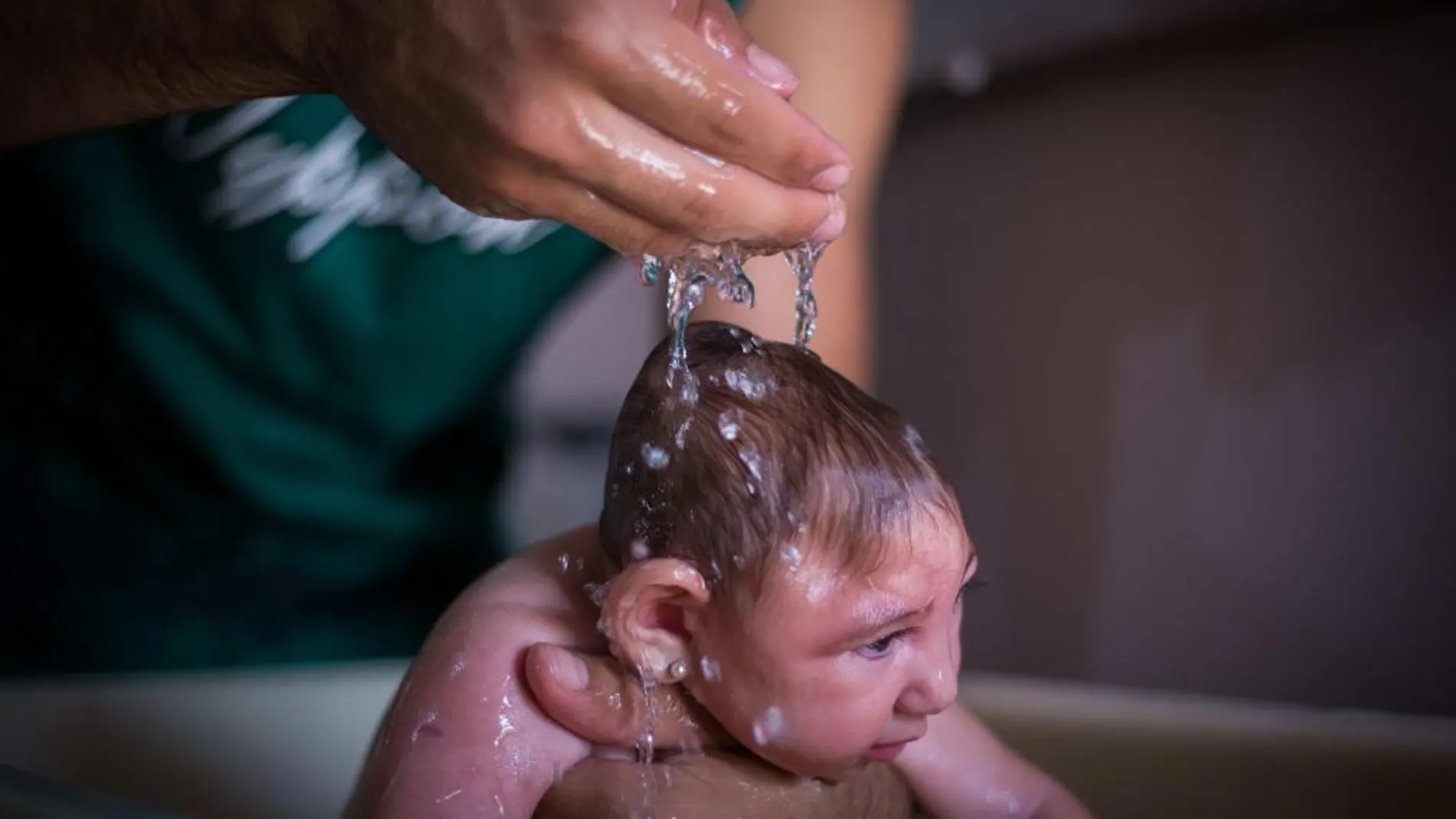 Fotografía del 8 de febrero de 2016, de Ana Beatriz, una niña con microcefalia que celebró 4 meses de vida en el municipio de Lagoa do Carro, Pernambuco (Brasil).