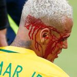 Así de aparatosamente sangraba Neymar tras el codazo de Yasmine Duk