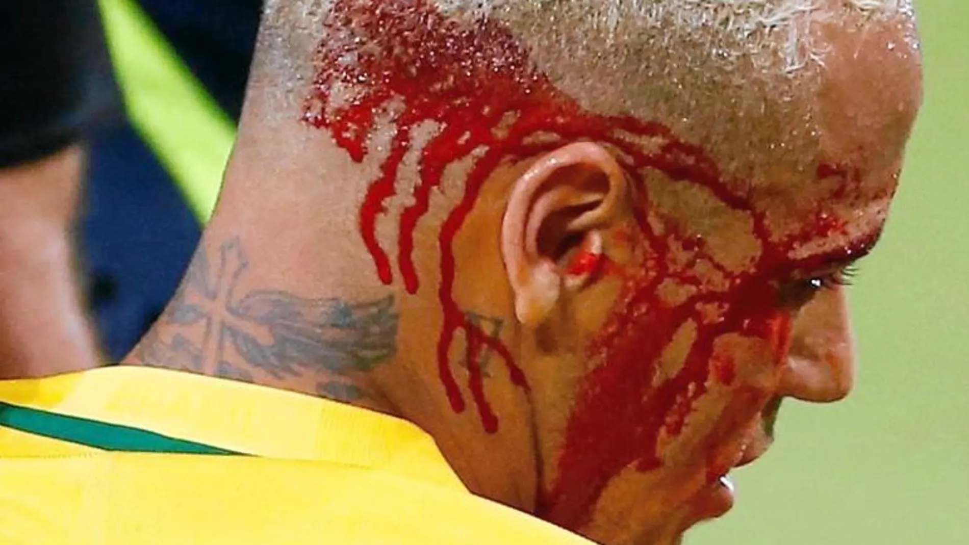 Así de aparatosamente sangraba Neymar tras el codazo de Yasmine Duk