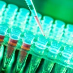 El agente inyectable, un líquido azul llamado LUM015, fue capaz de identificar los tejidos cancerosos sin efectos adversos
