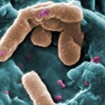 PSEUDOMONAS