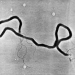 Treponema pallidum, causante de la sífilis