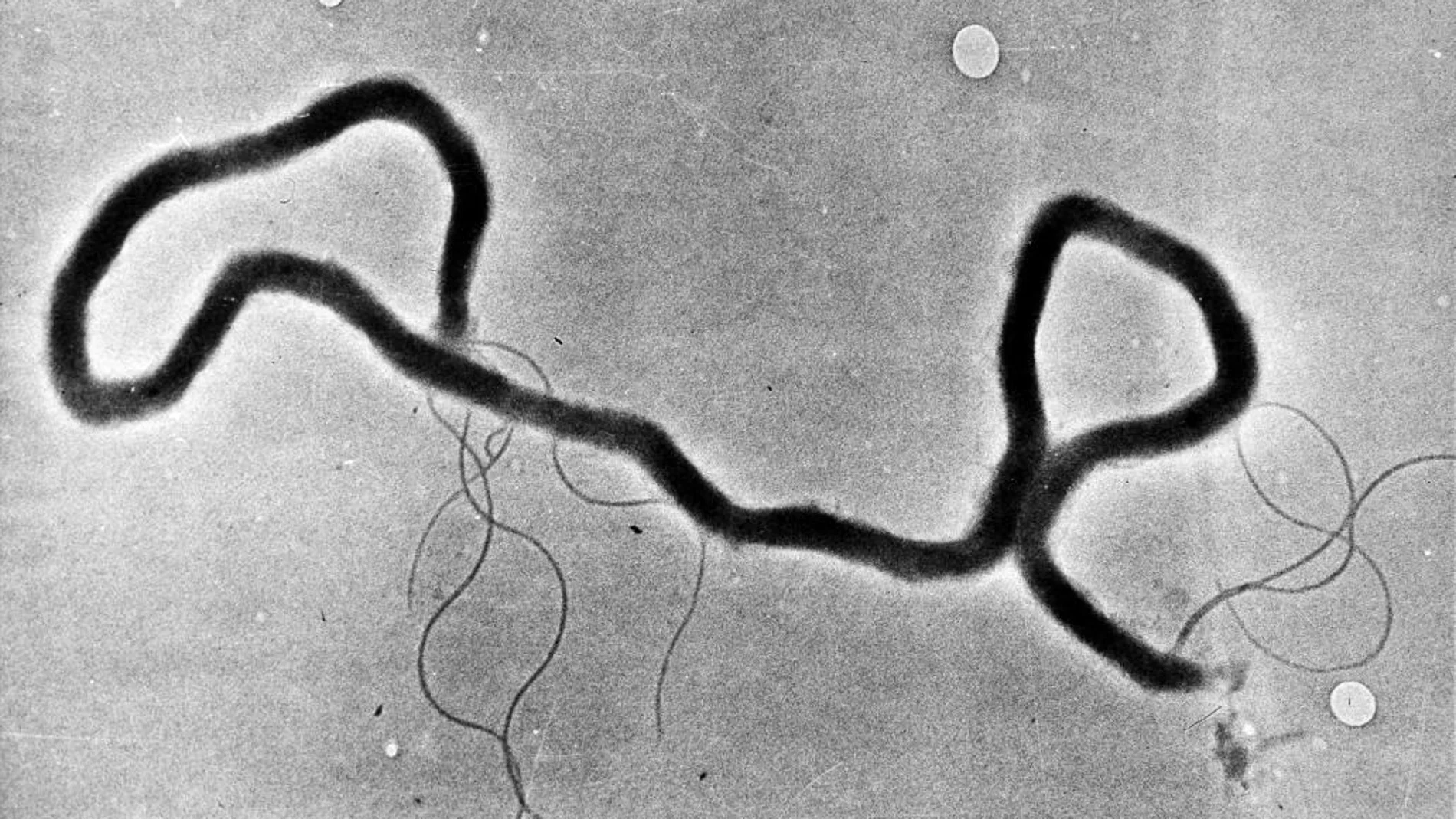 Treponema pallidum, causante de la sífilis