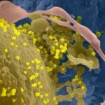Imagen de una célula infectada con el VIH