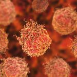 Biopsia fusión: el último avance diagnóstico del cáncer de próstata