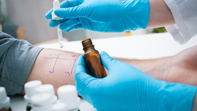 Cómo hacer frente a los síntomas de la alergia