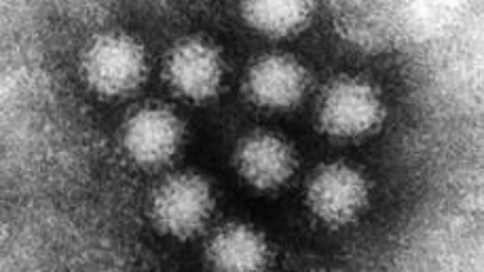 El norovirus visto al microscopio
