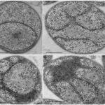 La Gemmata obscuriglobus