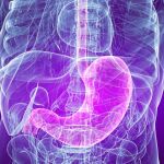La interrupción del microbioma intestinal con antibióticos antes de sufrir heridas en la médula espinal (izquierda) aumenta el número de células inflamatorias (derecha) en la región dañada de la espina dorsal