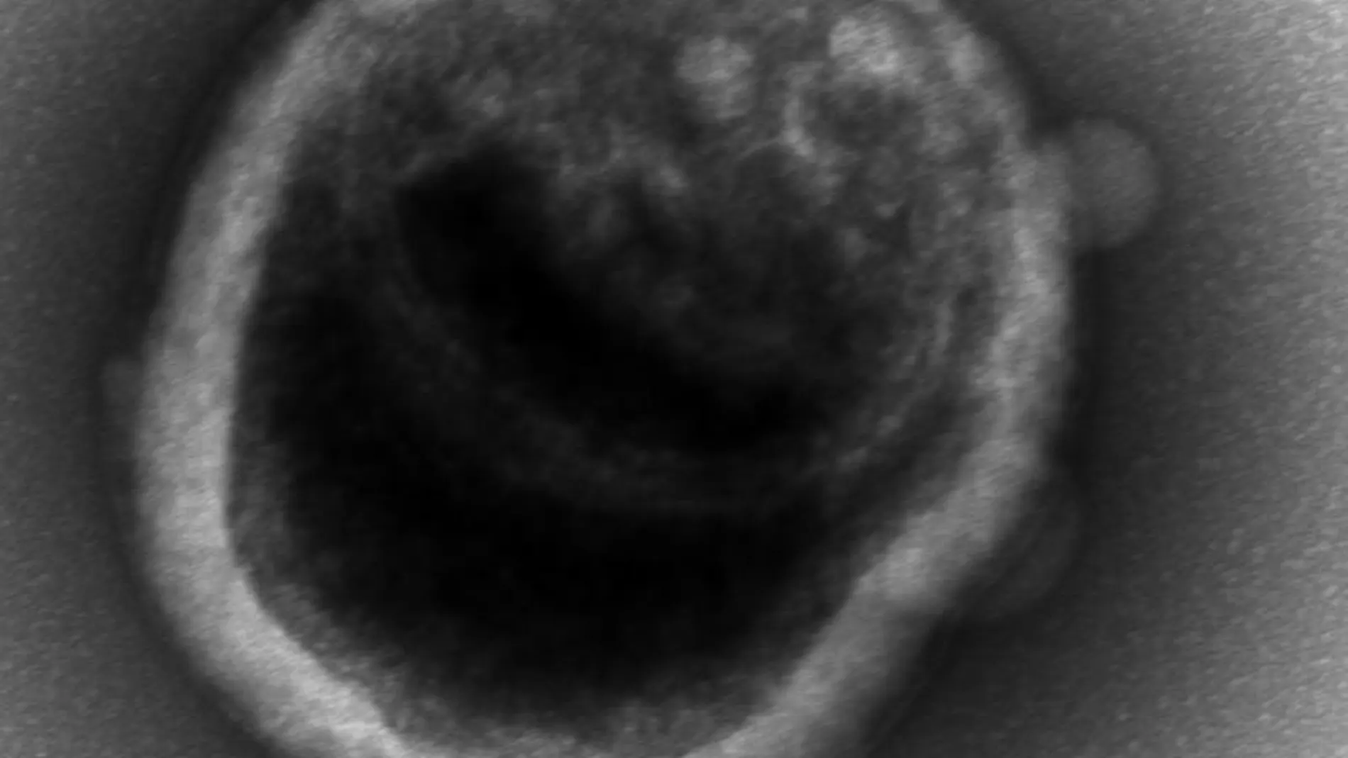 Una célula individual de una bacteria de una zona baja en oxígeno nacida en el laboratorio de la Universidad de Washington, vista al microscopio