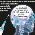 El «Botox» reduce hasta un 50% los síntomas de la migraña crónica