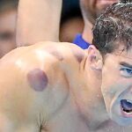 Las llamativas manchas en el cuerpo que lucía Michael Phelps