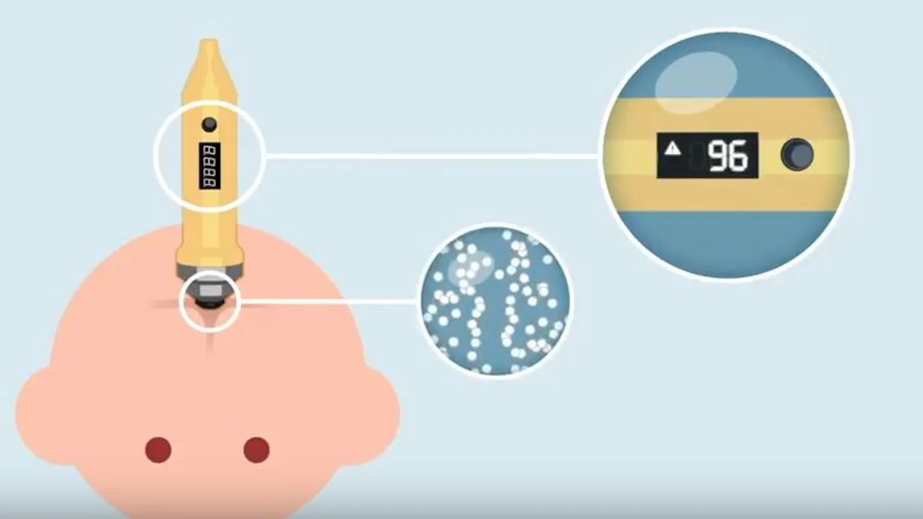 Crean un dispositivo que permite detectar la meningitis infantil en 3 segundos