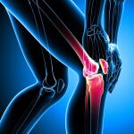 Nueva técnica que da más estabilidad a la rodilla tras la rotura del cruzado