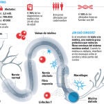 La esclerosis es una enfermedad neurodegenerativa que afecta a adultos jóvenes / Infografía LA RAZÖN