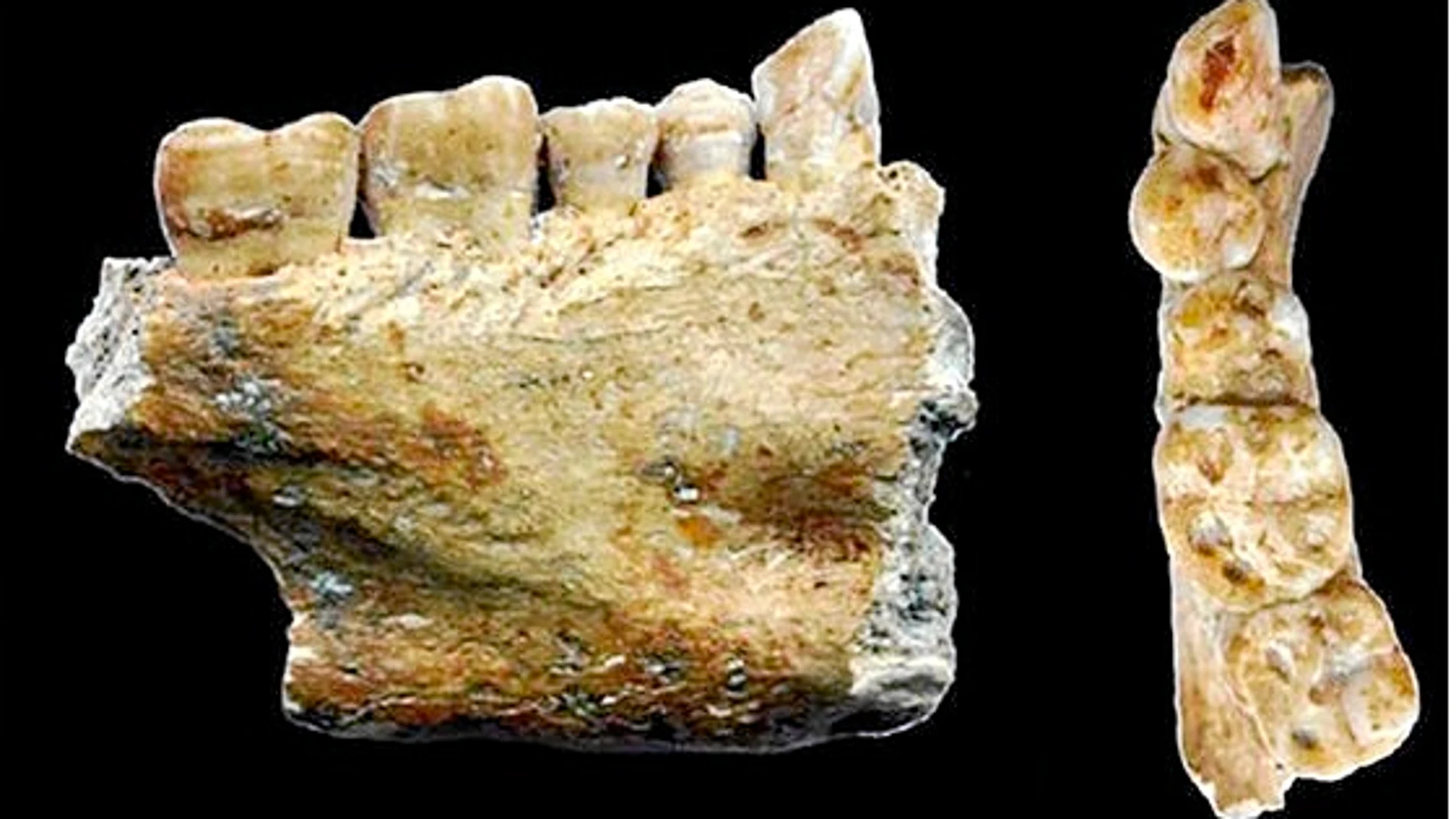 La mayoría de las mandíbulas descubiertas mostraban rasgos de decandencia dental e infección