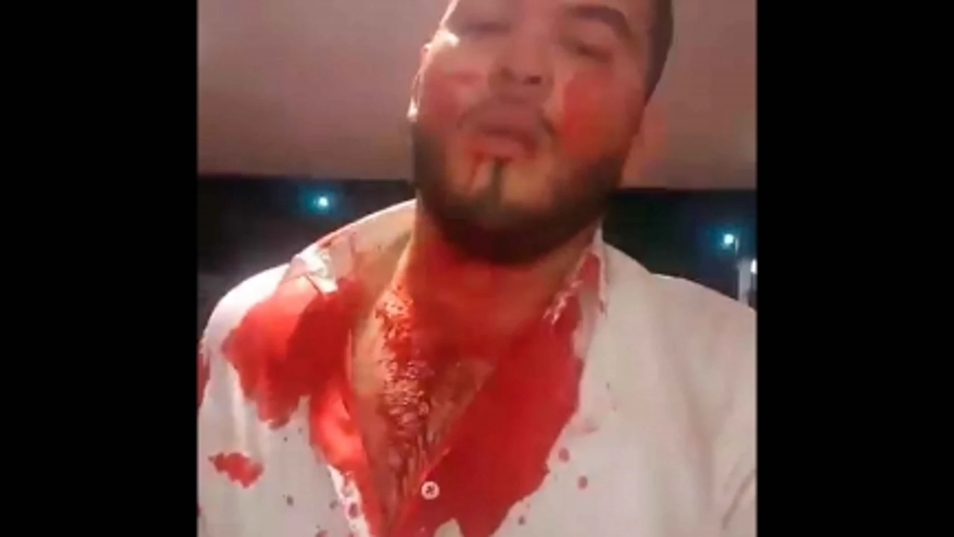 Disparan a un concursante de La Voz México y herido transmite en vivo su traslado al hospital