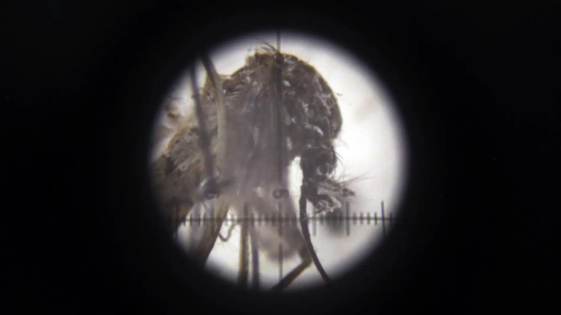 Un mosquito Aedes Aegypt visto al microscopio