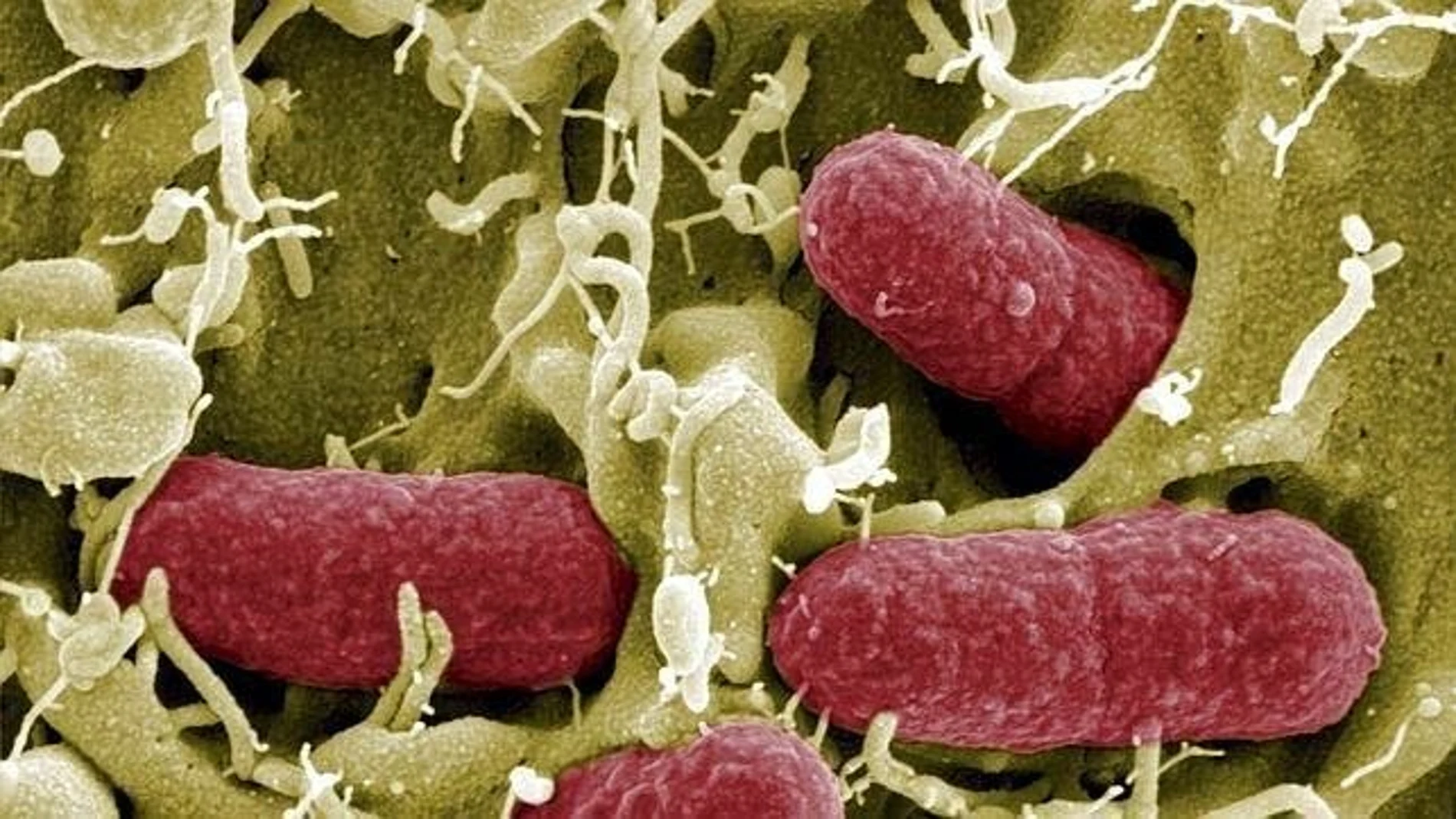 Bacterias de la flora intestinal vistas al detalle