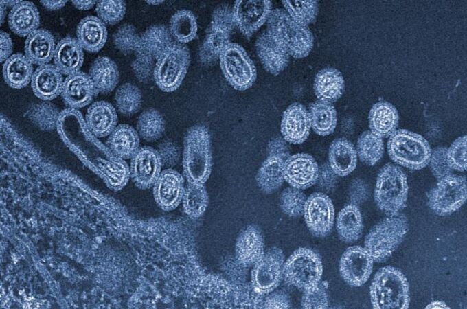 Virus de la gripe aviar H7N9