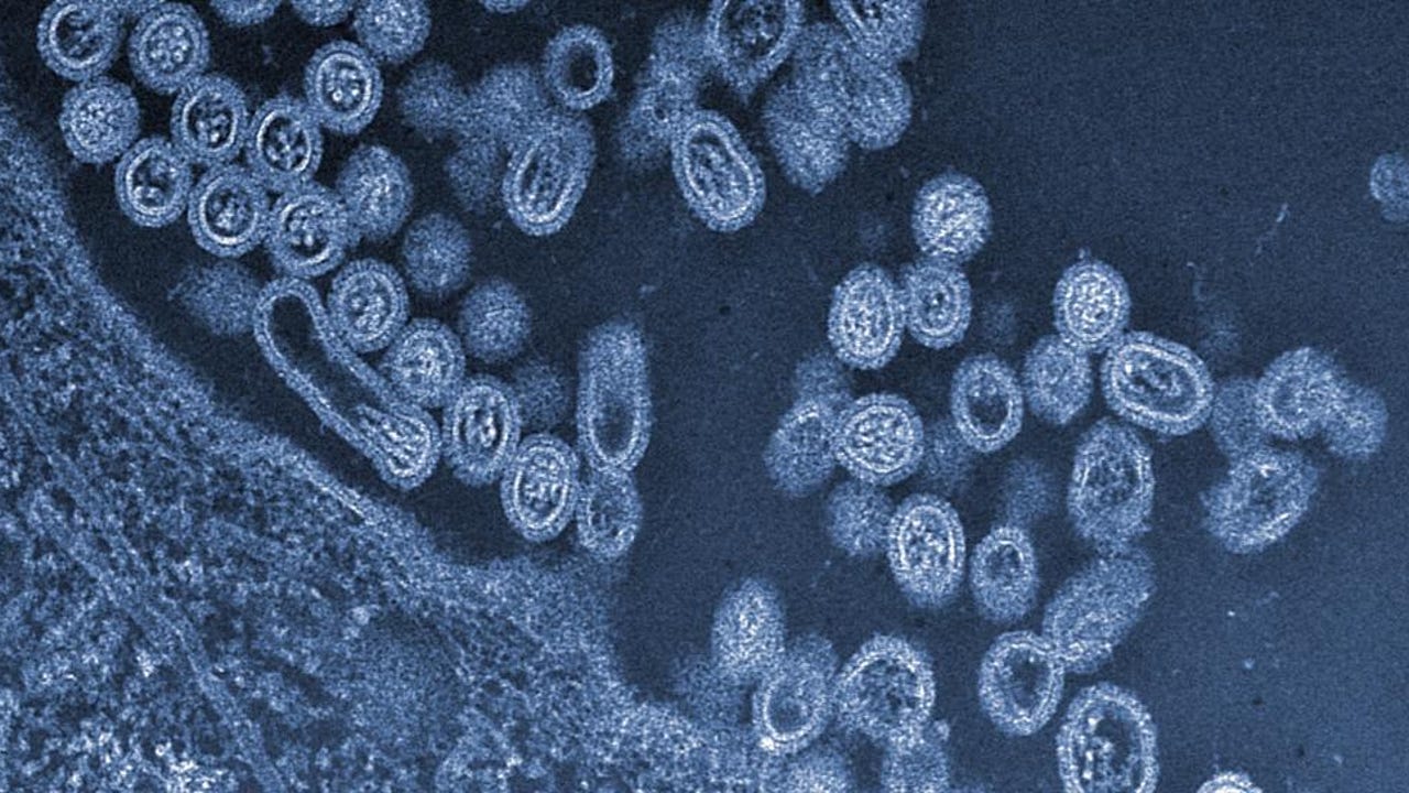 OMS alerta sobre tres amenazas para la salud global: ¿Cuándo sucederá el próximo brote?