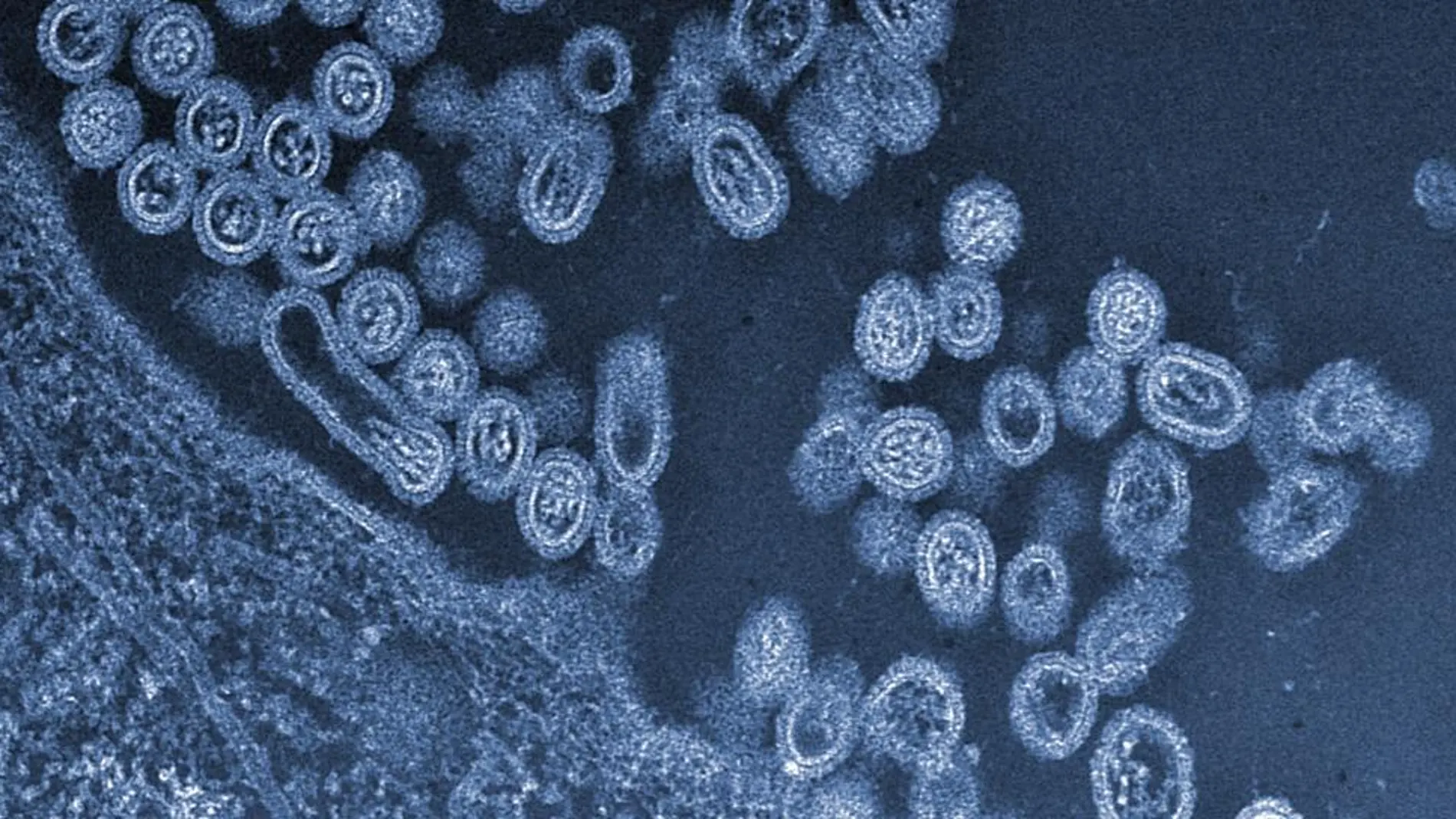 Virus de la gripe aviar