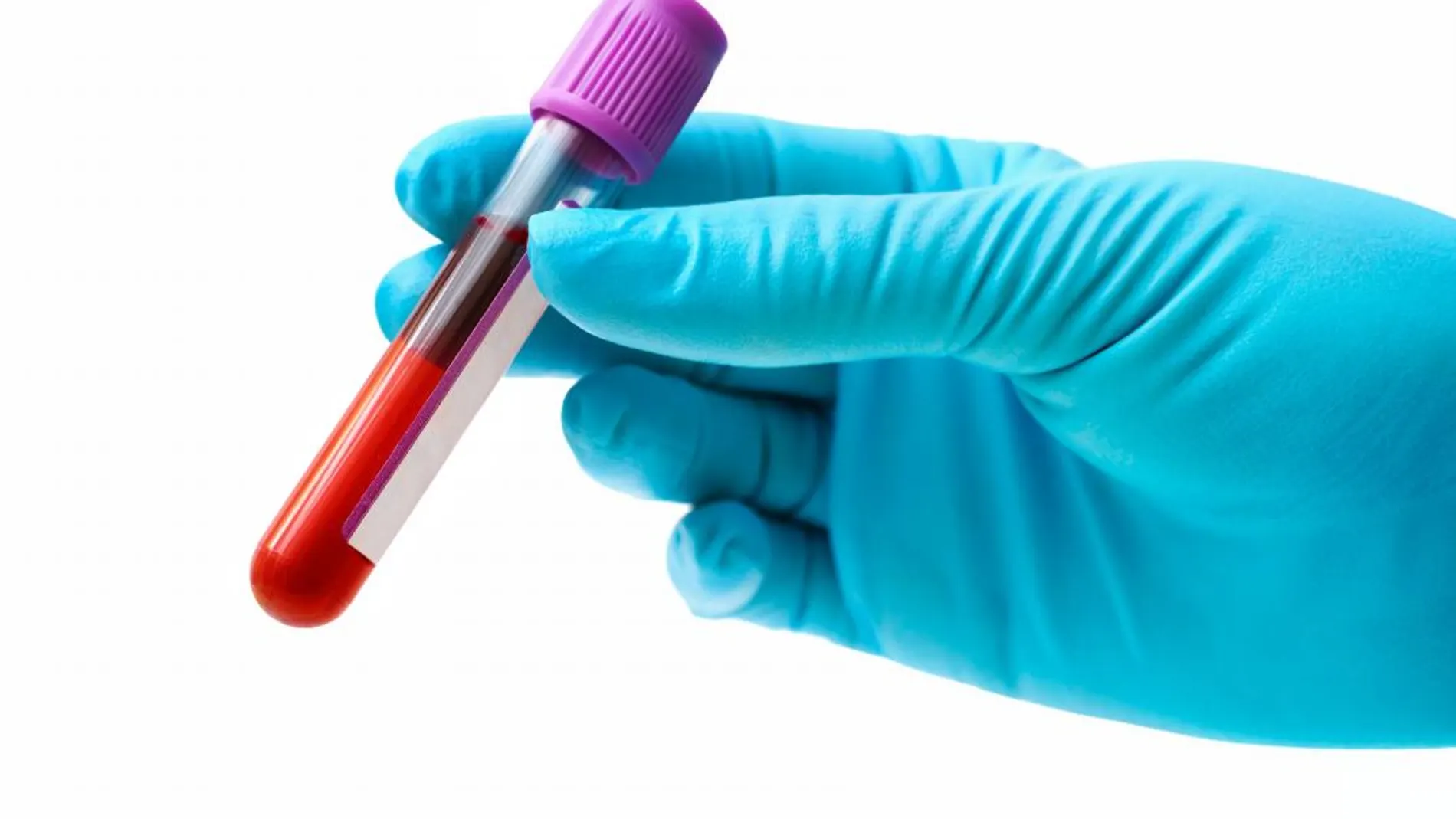 Crean un test de sangre capaz de detectar de forma temprana 8 tipos de cáncer