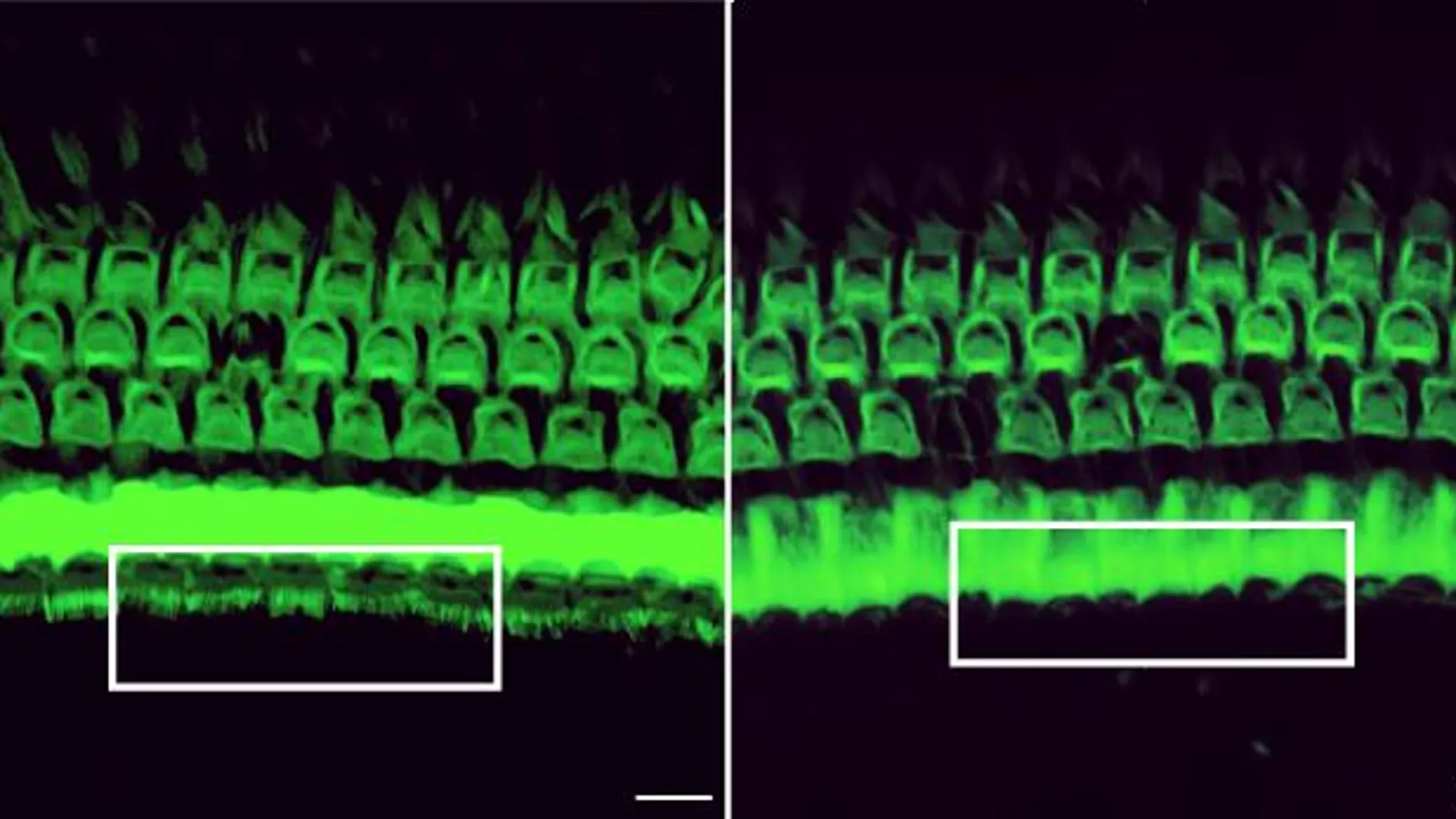 El tratamiento con un agente de edición del genoma puede preservar el oído en ratones.