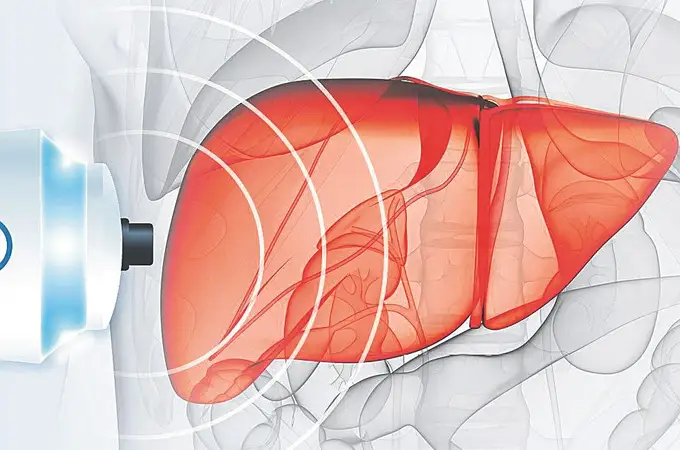 La técnica más precisa para evaluar el hígado en pacientes de riesgo
