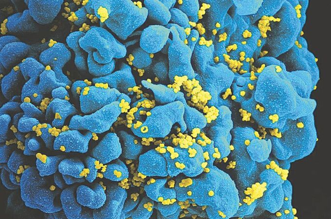 Célula infectada con el VIH