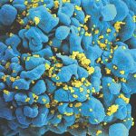 Célula infectada con el VIH
