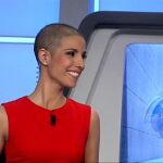 La presentadora que no oculta las consecuencias del cáncer