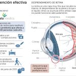 Una intervención efectiva