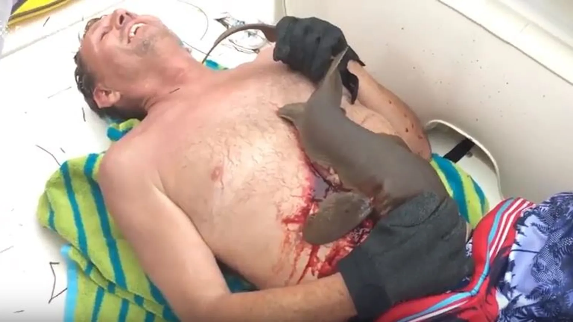 Ervin Maccarty con síntomas de dolor mientras intentar soltar al tiburón