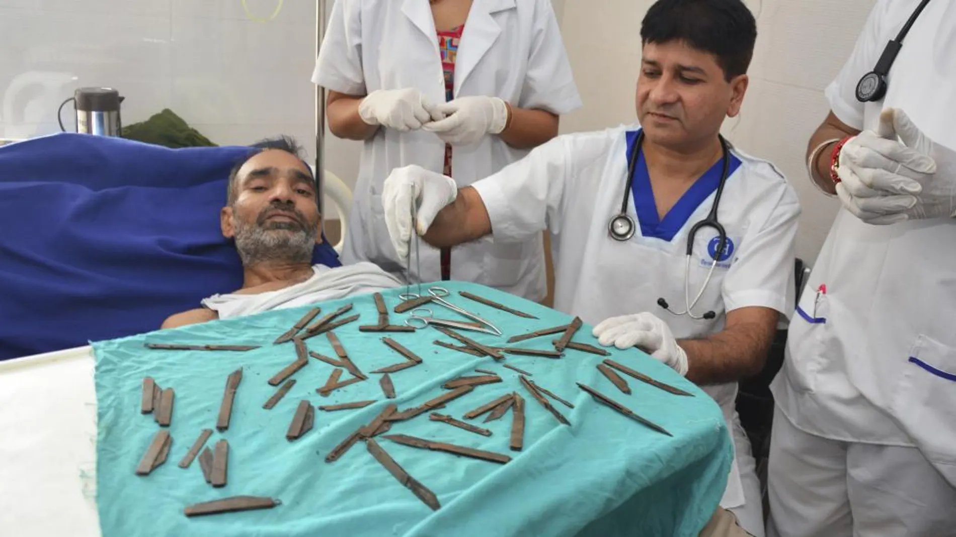 El cirujano Jatinder Malhotra con los 40 cuchillos y el hombre que se los comió