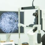 El Instituto Oftalmológico Gómez Ulla recluta pacientes para un nuevo ensayo clínico contra el edema macular diabético