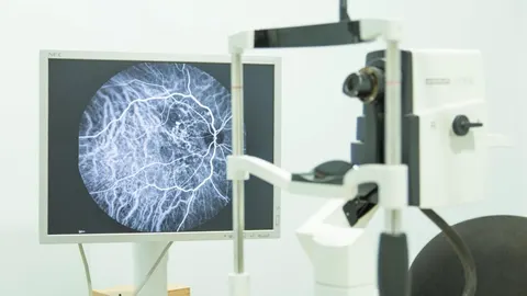 El Instituto Oftalmológico Gómez Ulla recluta pacientes para un nuevo ensayo clínico contra el edema macular diabético