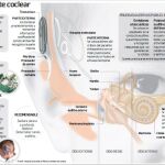 Seis especialidades para recuperar la audición
