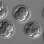 Embriones dos días después de la coinyección de los componentes CRISPR con el esperma del donante. / OHSU