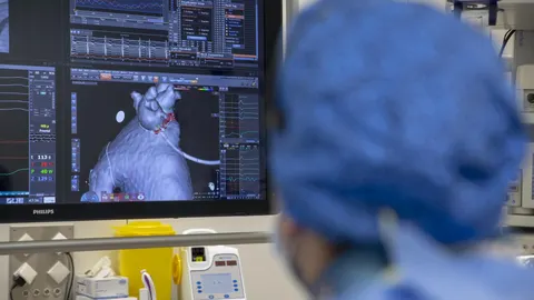Técnicas digitales para borrar las arritmias