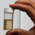Imagen de laboratorio de larvas del mosquito responsable del contagio de la enfermedad