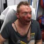 El agente de la Policía Nacional, de 40 años, agredido en Córdoba /Efe