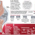 La artrosis no es sólo una enfermedad de mayores