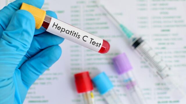 Trasplantes de órganos con hepatitis C