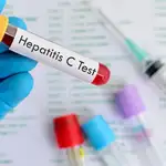  Trasplantes de órganos con hepatitis C